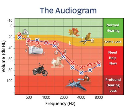 how to read speech audiometry results|Audiometry Screening and Interpretation .